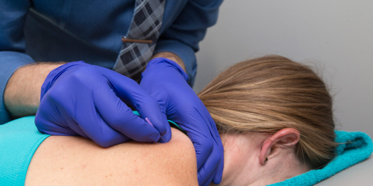 Headaches No More: Research Reveals Dry Needling’s Remarkable Impact